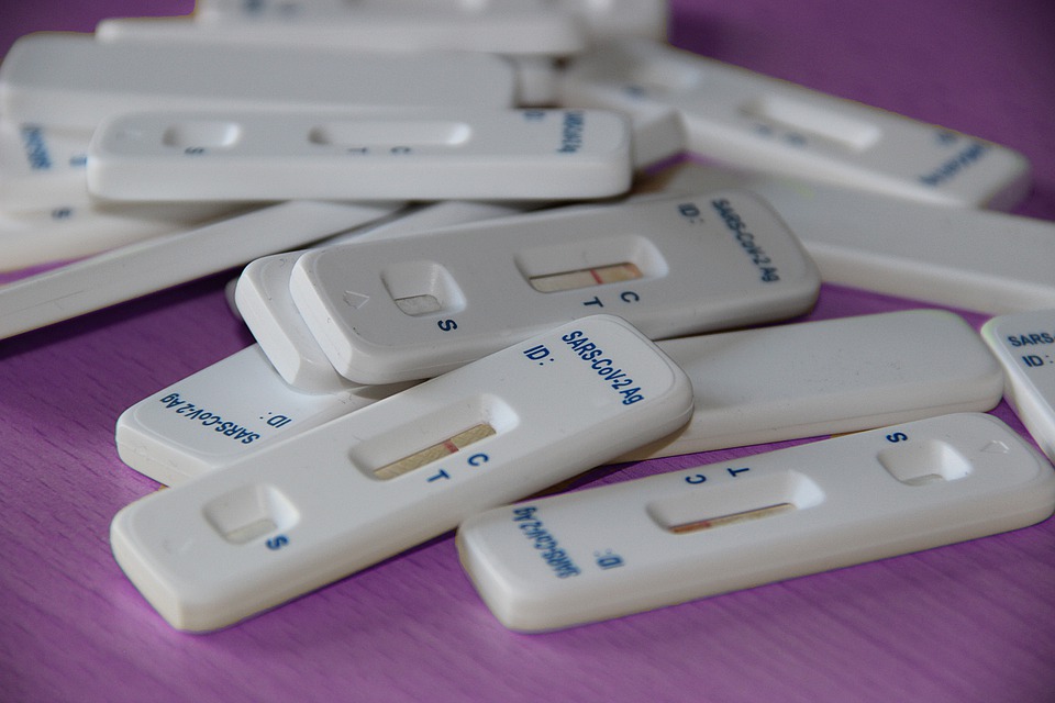 Águilas suma 20 nuevos contagios hoy martes y sube hasta los 215 casos activos