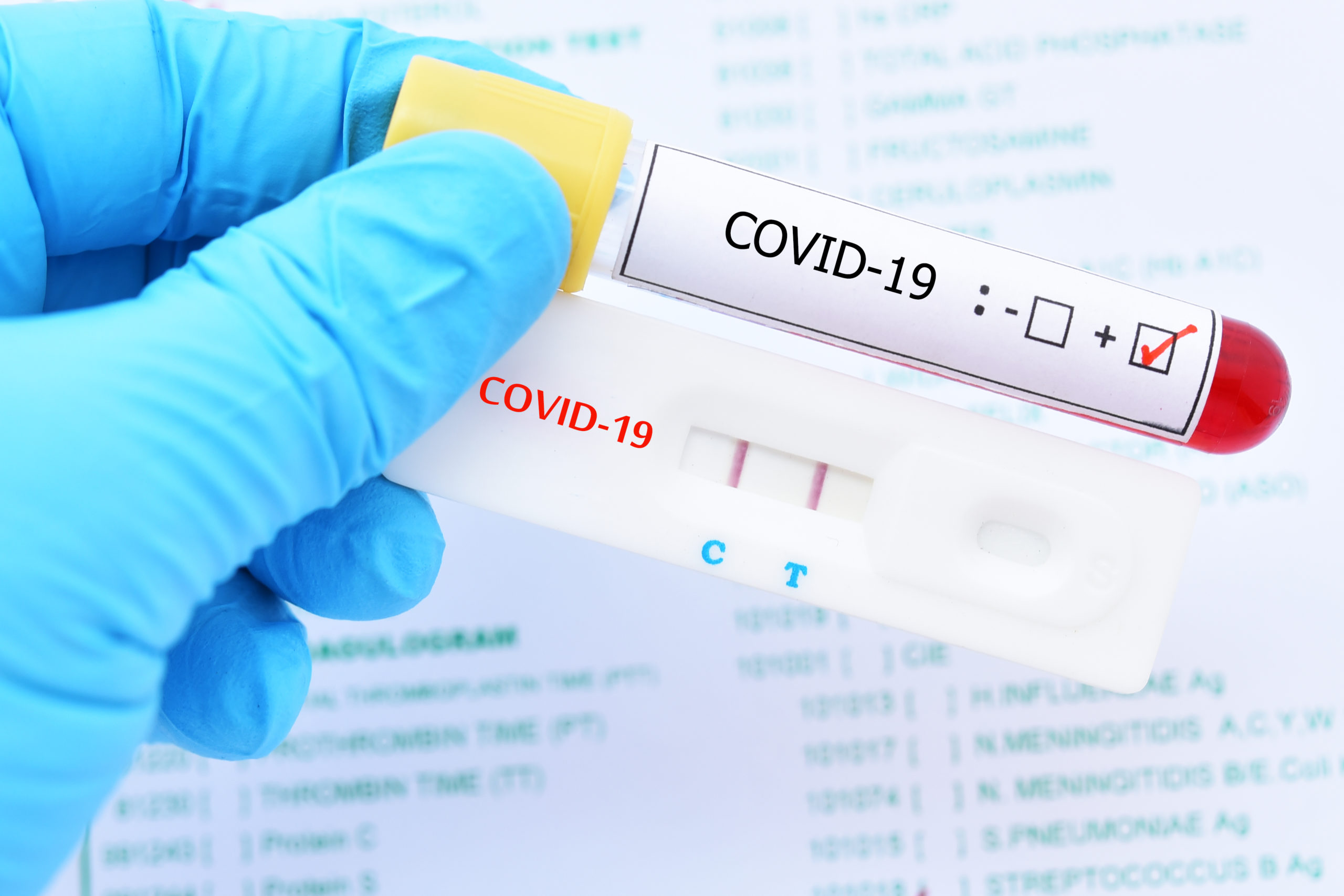 Águilas suma 141 nuevos contagios hoy sábado y cuenta con 881 casos confirmados en los últimos 7 días